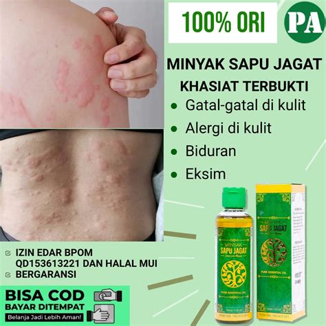 Jual Minyak Balur Gatal Kulit Obat Gatal Kulit Alergi Dingin Minyak