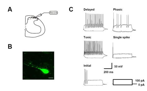 Firing Patterns In Sg Neurons In Wild Type And Glur5 Mice A