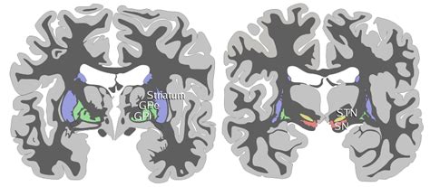 Striatum | Psychology Wiki | FANDOM powered by Wikia