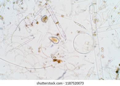 Marine Aquatic Plankton Under Microscope View Stock Photo 1187520073 ...