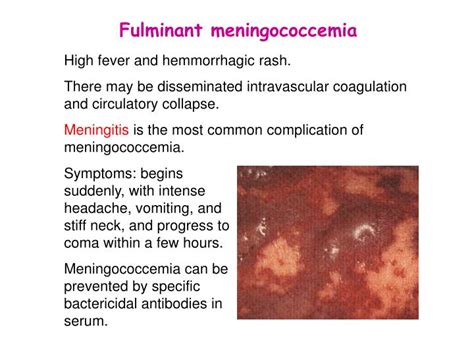 PPT - Neisseria N. gonorrhoeae (gonococcus): gonorrhea N. meningitidis : meningitis PowerPoint ...