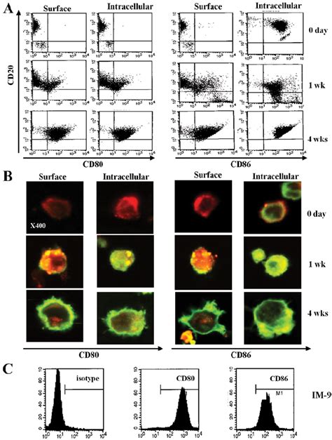 CD80 And CD86 Expression On EBV Transformed B Cells And EBV Positive