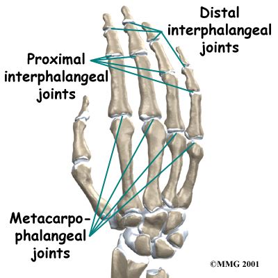 Physical Therapy in Conway for PIP Joint Injuries of the Finger