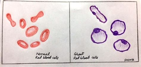 GLAUCOMA SPECIALIST BLOG: "THE GLOG"