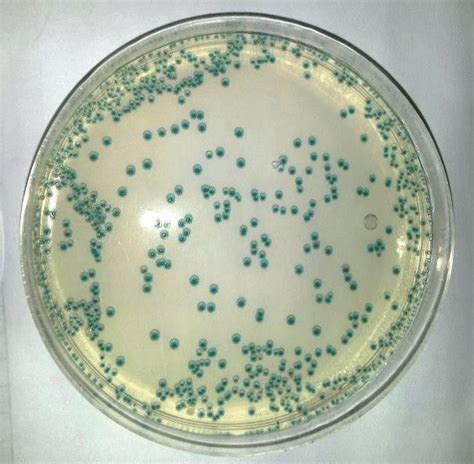 Vibrio Vulnificus Scheda Batteriologica Ed Approfondimenti