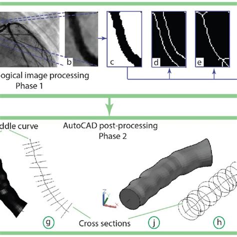 Shows the skeletonization process applied to a portion of the blood ...