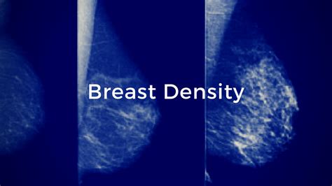 Breast Density The Breast Cancer School For Patients