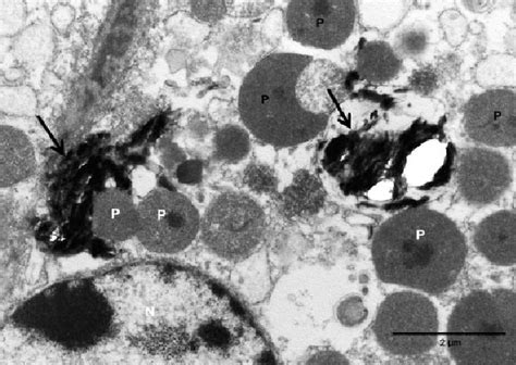 Transmission Electron Micrograph Liver Bovine Electron Dense