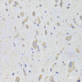 High Affinity And Specificity KO Validated EEF1B2 Polyclonal Antibody