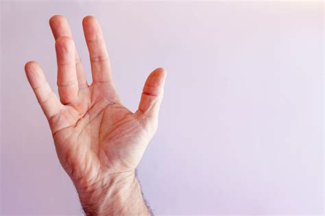 Dupuytrens Contracture Vs Trigger Finger Arora Hand Surgery