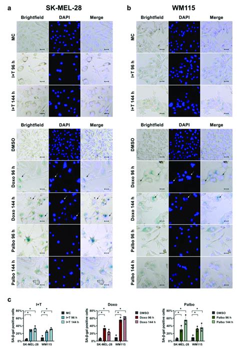 Induction Of Sa Gal Activity After Treatment With Ifn And Tnf