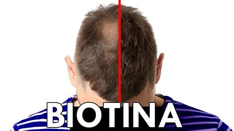 BIOTINA para el PELO explicado por MÉDICO FUNCIONA YouTube