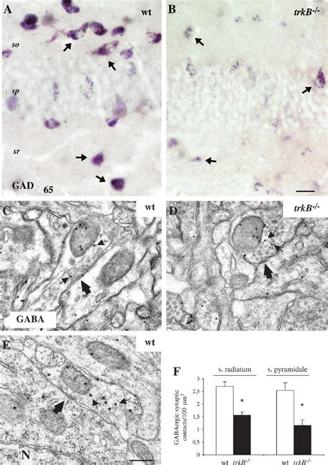 Gad 65 Expression And Gabaergic Synaptic Contacts Are Decreased In