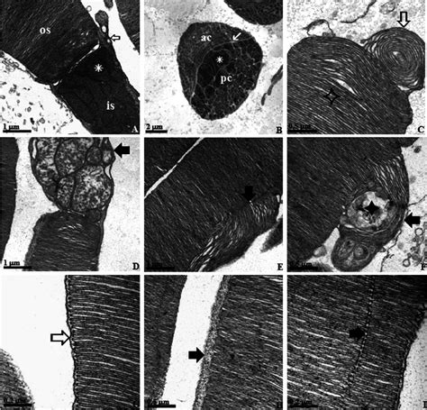 Electron Micrograph Of The Photoreceptors In Retina Of Hoplias