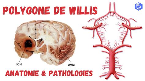 Cercle Art Riel Du Cerveau Polygone De Willis Anatomie Descriptive