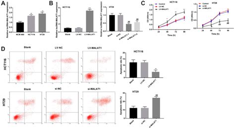 LncRNA MALAT1 Promotes The Proliferation And Inhibits The Apoptosis Of