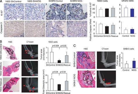 Histological And Histomorphometric Analysis Of 1833 And SKBr3 Cells