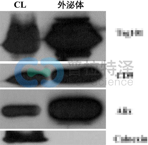 Western Blot检测实验常见问题原因及解决方法（中）