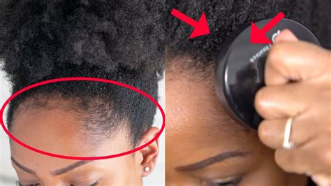 How To CARE FOR And GROW BACK Your EDGES In 3 EASY PRACTICAL STEPS