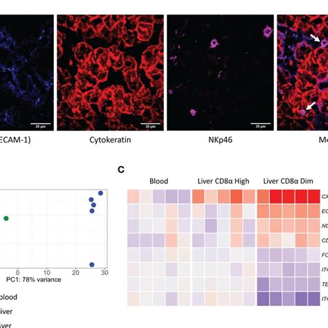 Liver Resident CD8a Dim NK Cells Are Located In The Liver Sinusoids And