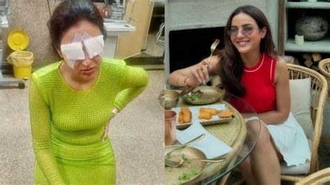 Jasmine Bhasin Says Her Corneas Got Damaged After She Wore Lenses Is