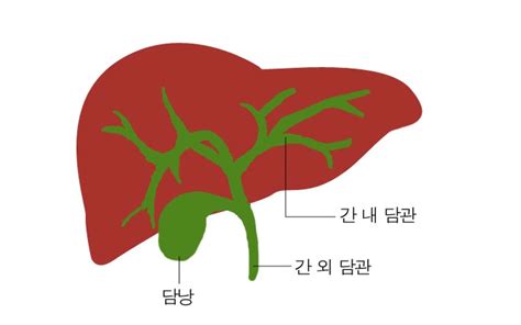 담도암 담관암 증상 1기 2기 3기 4기 생존율 세상의 모든정보