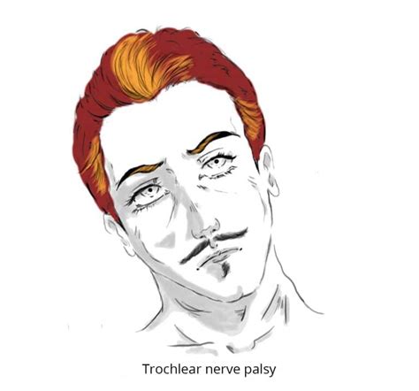 The Trochlear Nerve (CN IV) - Course - Motor - TeachMeAnatomy