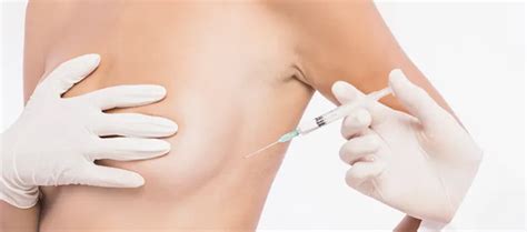 Lipofilling Mammaire Avantages Co T Complications Et R Sultats