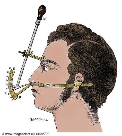 Bertillon S Anthropometry Bertillon S Anthropometry A Bertillon