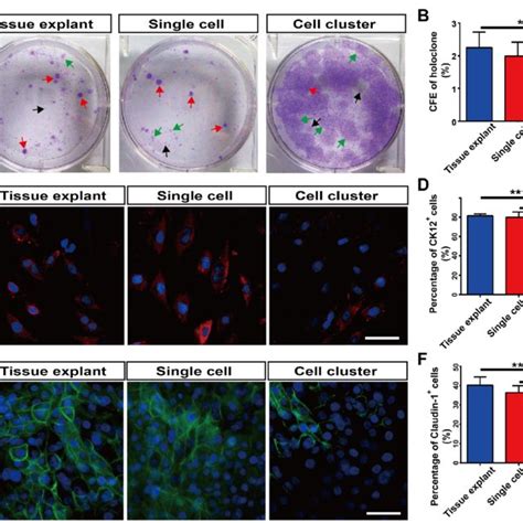 Colony Forming Efficiency CFE And Corneal Epithelial Cell Marker