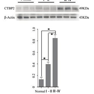 Ctbp Protein Expression In Normal Brain Tissues And Different Grades