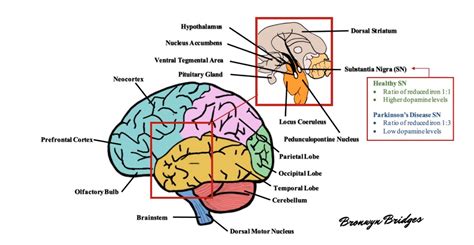 The Pathology Of Parkinsons Disease Encyclopedia Mdpi