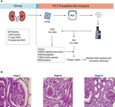 Frontiers Stratification Of Diabetic Kidney Diseases Via Data