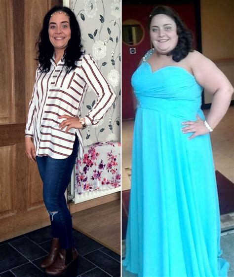 400 Pound Woman Loses Weight Without Dieting