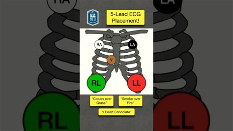 12 Lead Ecg Placement Color Coded