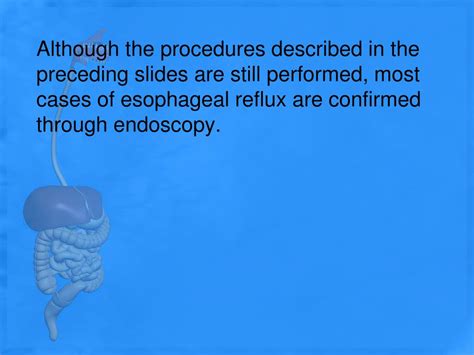 PPT - ESOPHAGRAM PowerPoint Presentation, free download - ID:3086985