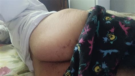 My Dick And My Ass Disabled Gay Pics Xhamster