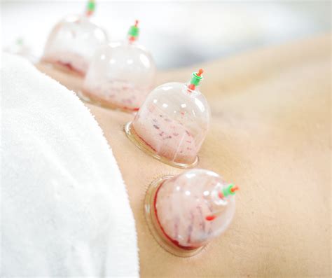 Cupping Therapy Adelaide Online Appointments Sa Wellness Centre