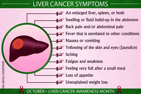 Liver cancer symptoms infographic vector illustration. Health ...