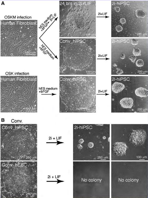 Generation Of Human Multipotent Stem Cell Lines In 2i Lif Medium A