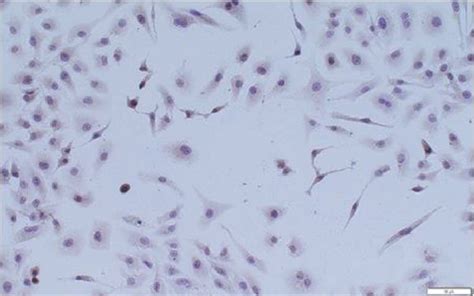 Differentiation Of Huc Mscs To At Ii Cells In Vitro A Qrt Pcr Was Download Scientific