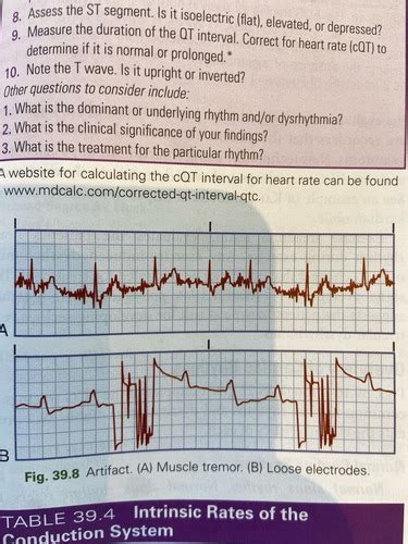 Cardio Exam 2 Flashcards Quizlet