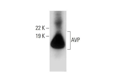 AVP抗体 E 8 SCBT Santa Cruz Biotechnology