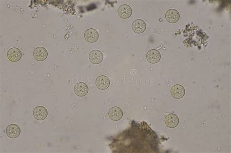 Entamoeba Coli Cysts Stage In Stool Exam Stock Image Image Of Medicine Life 153962763