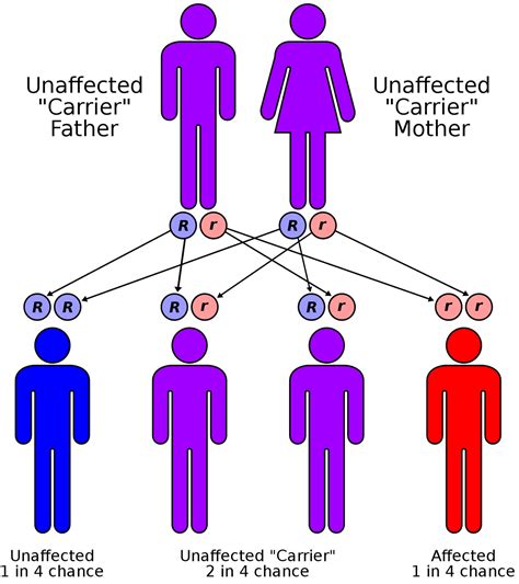 Microcytic Anemia Causes Symptoms Treatment