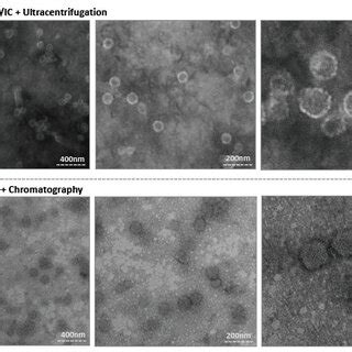 Electron Micrographs Of Purified L P I Vlps A Morphology Of