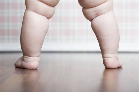 Common Rashes That Can Show Up On Baby S Legs