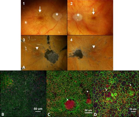 Representative Images Of Retinal Pigment Epithelium Rpe F Latmounts