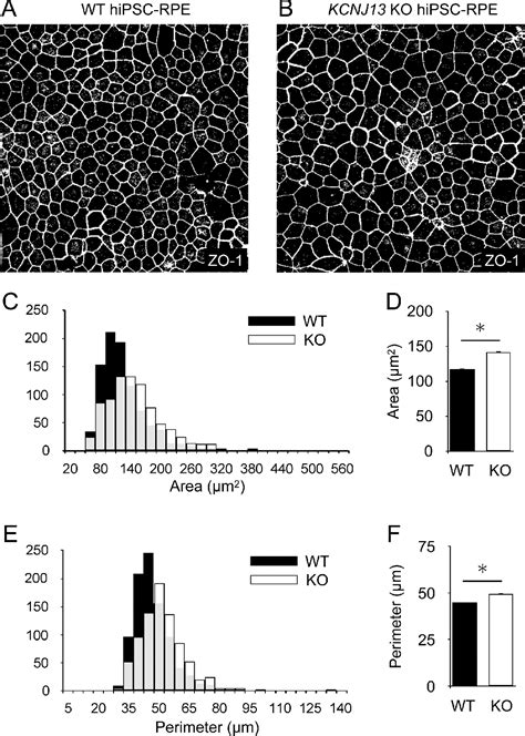 Figure From Protrusion Of Kcnj Gene Knockout Retinal Pigment