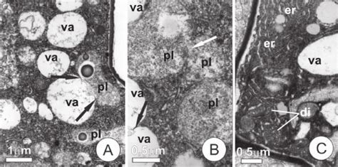 Ultrastructural Organization Of The Glandular Cells Of Glandular